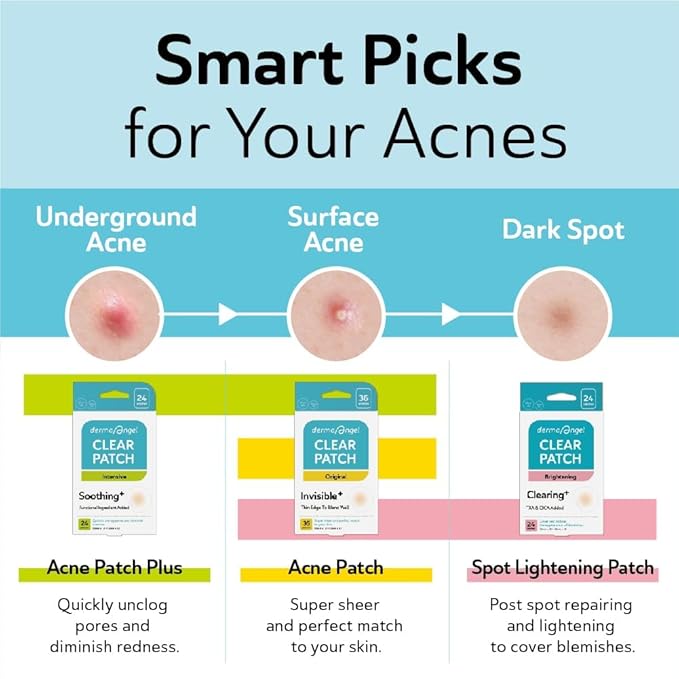 DERMA ANGEL Dark Spot Patches Blemish Patches with Hydrocolloid, TXA & CICA for Active Acne & Post-Inflammatory Dark Spots - Day and Night Use - UPGRADED (Post Acne - 192 Count - 1 Size)