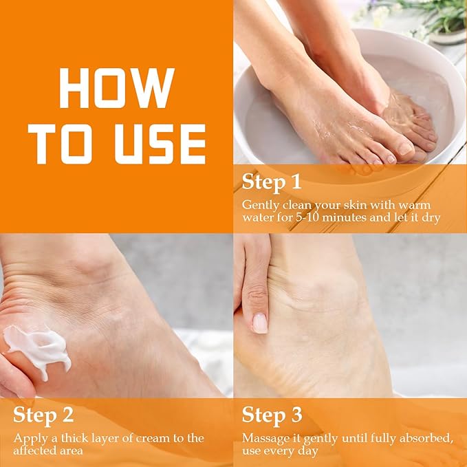 YOUNGYOUNGLOVE Fragrance Free 60% Urea Cream plus 2% Salicylic Acid, for Dry Cracked Hands Knees Feet Heels, Repair Unscented Foot Cream for Dead Skin, Lotion for Moisturizing and Softening 6.76 OZ