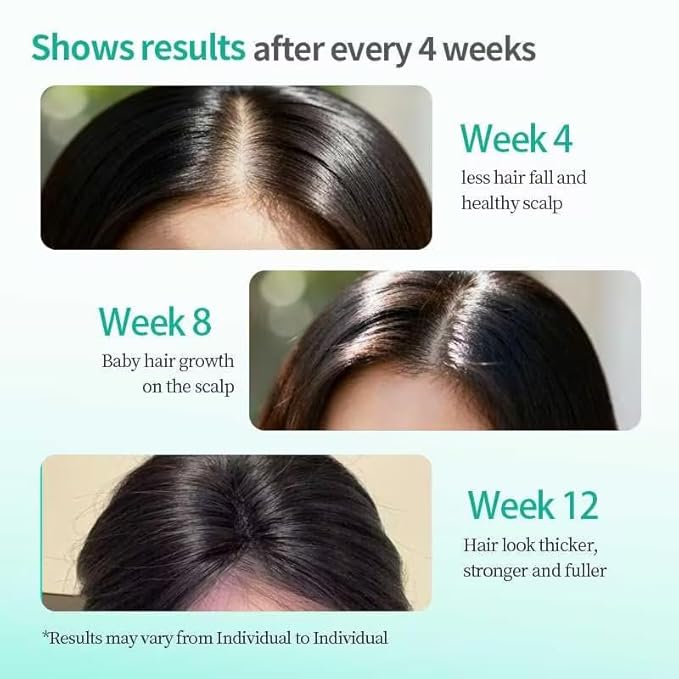 BEKSF Rosemary Hair Oil, a lightweight rosemary essential oil spray, suitable for all scalps and hair, free of parabens and sulfate surfactants, 15ml. (3, 10.5ml)