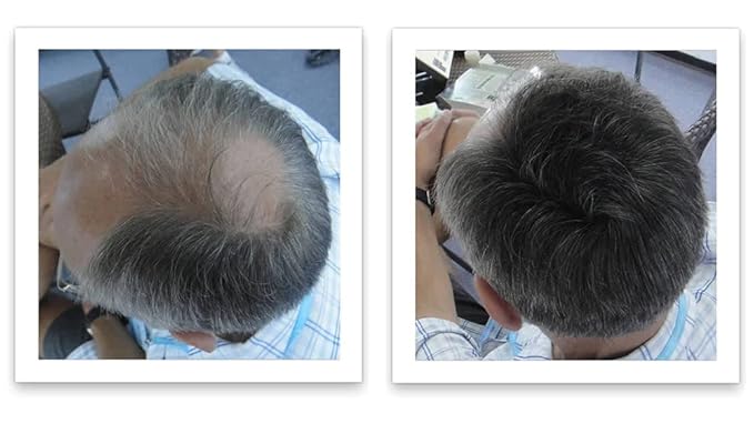 Caboki Hair Loss Concealer, 90-day supply, Dark Gray