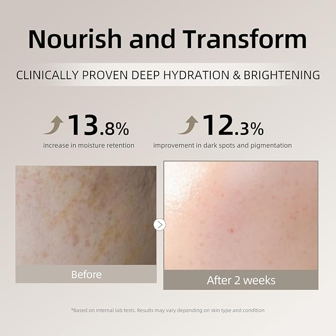 DEEOM Real Yam Brightening Toner, Hydrating Milky Toner for Face with Rice Water, Yam Extract & Niacinamide, Korean Moisturizing Facial Toner, Alcohol Free, Glow Enhancing, 300ml