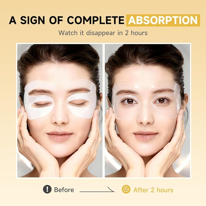 8 Pairs 5% PDRN Under Eye Patches, 6-in-1 Bio-Collagen 360° Eye Patches for puffy eyes, dark circles & Wrinkle | 2% Caffeine, Kojic acid, Retinol, Hyaluronic, Niacinamide | Korean Popular Eye Mask