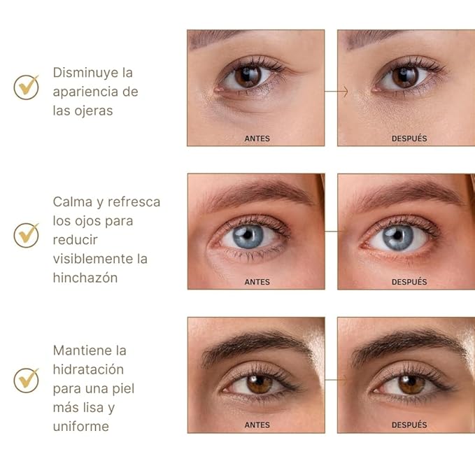 BRAWNA Under Eye Patches – Hydrogel Masks with Collagen, Peptides & Kojic Acid – For Puffy Eyes, Fine Lines, Dark Circles & Brightening – Rose – 24 Pairs