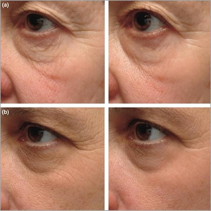 Instant Firming Eye Serum - Anti-Aging Formula for Under Bags and Wrinkles, Under Eye Cream, Wrinkle Filler, Visibly Improves for Bags Dark Circles Treatment for Puffines | 10ml