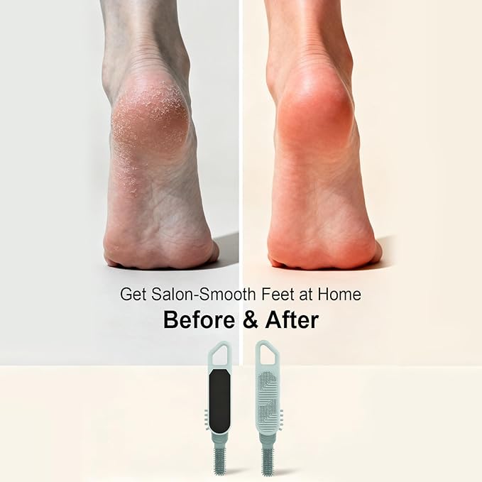 MVRPOWER Dry or Wet Foot Callus Remover - Dual-Sided Pedicure Tool with Hidden Brush & Non-Slip Grip for Home Salon Use