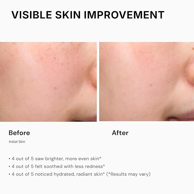 Niacinamide 4% Brightening Cream for Dark Spots & Uneven Tone, Fragrance-Free Daily Face Moisturizer for Sensitive Skin, Korean Skincare (50ml / 1.7 fl. oz.)