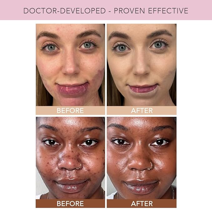Doll 10 TCE Liquid Filter – CC Cream - Liquid Foundation - Lightweight Tinted Moisturizer & Skin Tint - Blurs Pores & Fine Lines - Vegan - Clean Makeup - [Fair] - 30 Day Supply