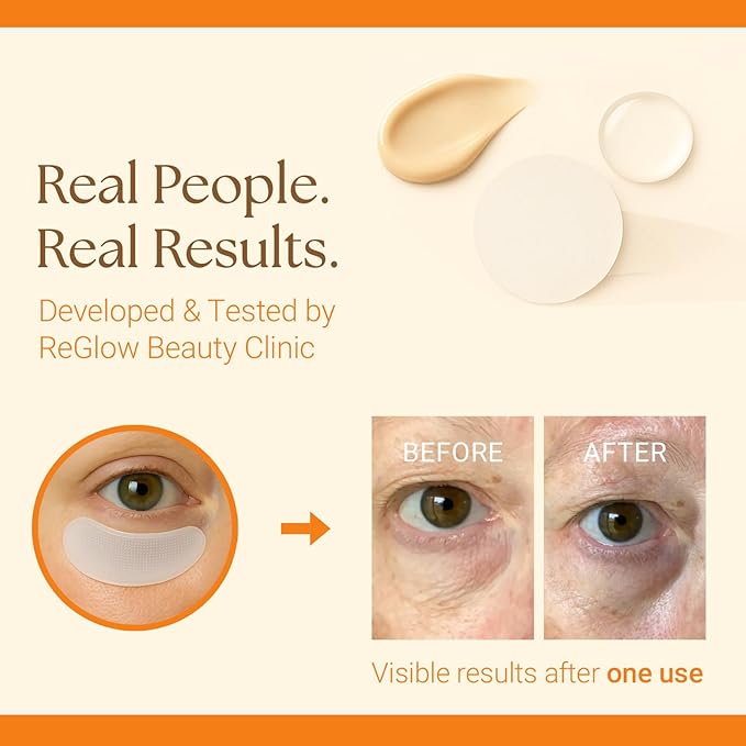 ReGlow Micro-Infusion Eye Patches – Anti-Aging Under Eye Mask with Hyaluronic Acid, Collagen & Peptides – Helps Reduce the Look of Dark Circles, Puffiness & Fine Lines - 1 Pair