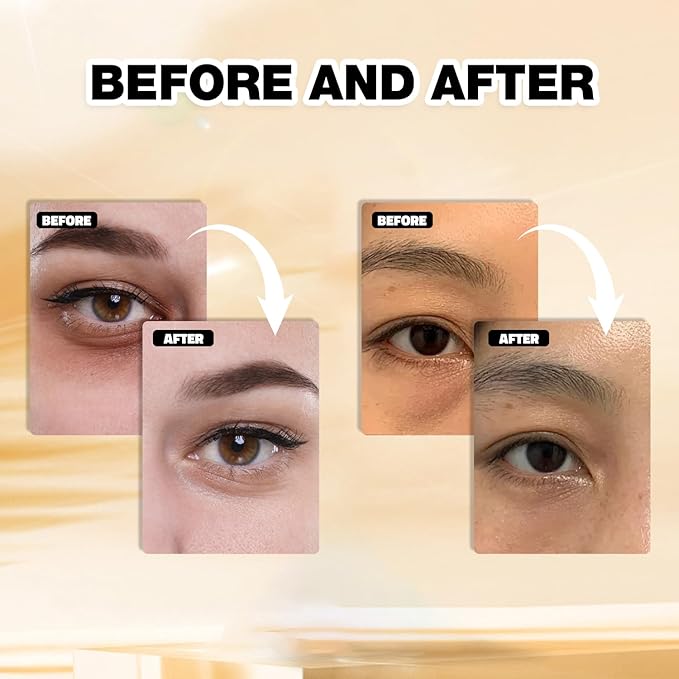 Gold Under Eye Masks – 24 Pairs Collagen & Hydrating Gel Eye Patches for Dark Circles, Puffy Eyes, Fine Lines & Anti-Aging Skincare – Vegan, Cruelty-Free Self Care Essentials