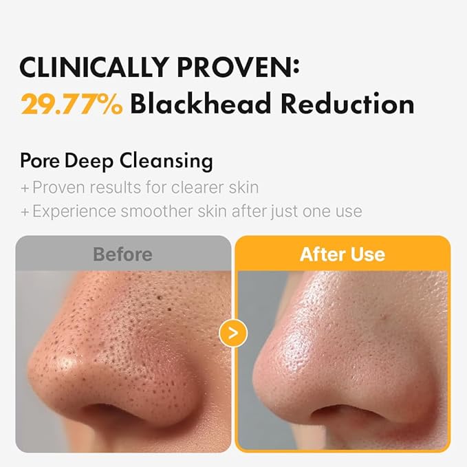Hanskin Pore Cleansing Oil, Oil Cleanser for Face, Makeup Blackhead Sebum Remover, Korean Deep Pore Cleanser for Sensitive Skin [PHA] (10.14 oz)
