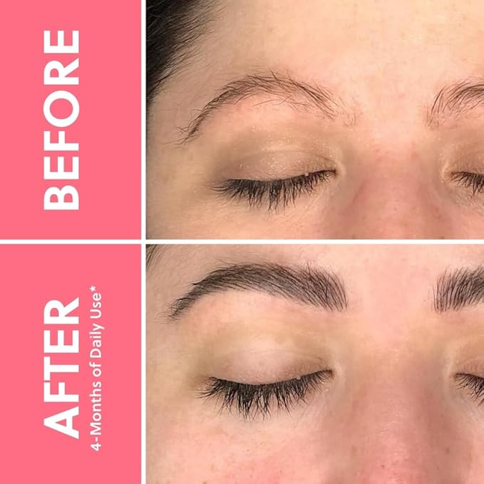 ForChics Lash & Brow Growth Bundle - Complete Eye Makeover Kit - Hormone-Free, Prostaglandin-Free Duo for Longer Lashes & Fuller Brows in 2 Weeks - Natural, Vegan [2x 3mL]