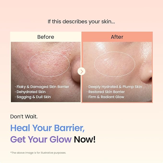BIODANCE Barrier Rescue Duo: Caviar PDRN & Ceramide Panthenol Real Deep Overnight Gel Mask for Hydrating Plumping for Glass Skin, Korean Skin Care, Gifts for women, Skin Care Set