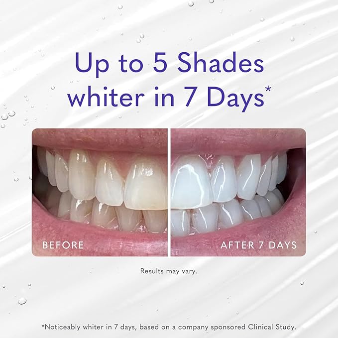 Smileactives Teeth Whitening Gel for Toothpaste with Clinical-Grade Hydrogen Peroxide, Tooth Stain Remover for White Teeth, Dentist Quality Pro Whitening Gel to Remove Coffee Stains, 2 oz Bottle