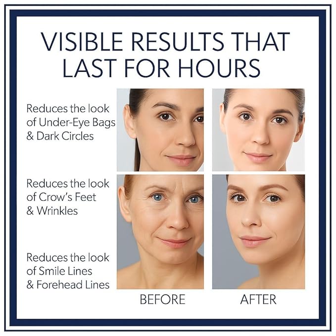 Instant Firming Eye Serum - Anti-Aging Formula for Under Bags and Wrinkles, Under Eye Cream, Wrinkle Filler, Visibly Improves for Bags Dark Circles Treatment for Puffines | 10ml