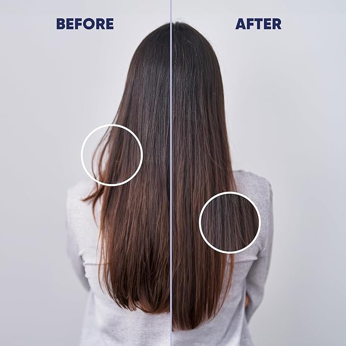 MOERIE Ultimate Hair Growth Serum for Natural Hair Regrowth & Thickening - Anti Thinning & Hair Loss Treatment for Women - Rapid Hair Growth Products - Scalp Oil Alternative - 1.69 fl oz, 2 pack