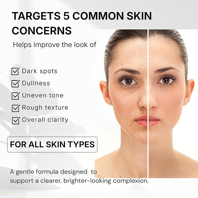 Niacinamide 4% Brightening Cream for Dark Spots & Uneven Tone, Fragrance-Free Daily Face Moisturizer for Sensitive Skin, Korean Skincare (50ml / 1.7 fl. oz.)