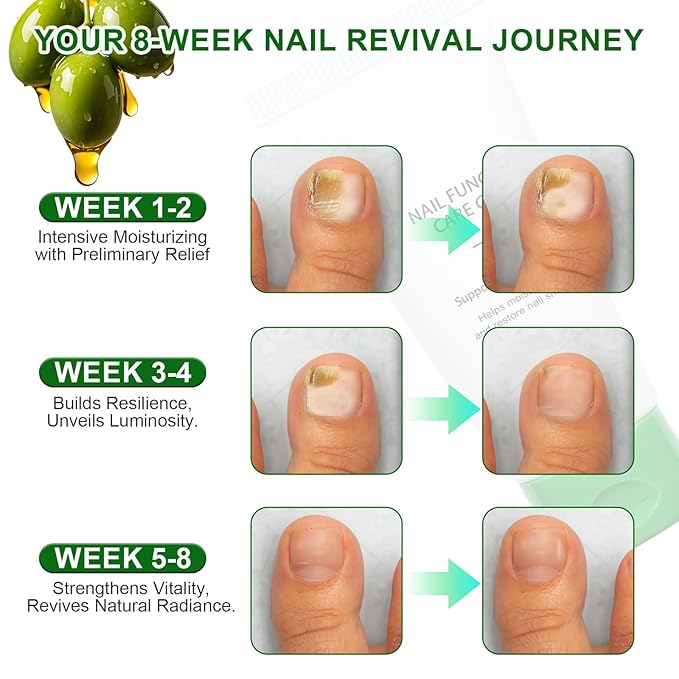 Natural Nail Repair Care Gel,Nail Growth Repair Cream, Multi-Purpose Nail Repair Treatment Gel for Feet