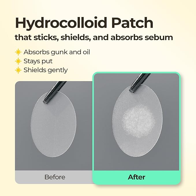 SINSURU BHA Iconic Spot Patch with Mirror Case - Hydrocolloid Patches with 5,000ppm Salicylic Acid - Day & Night Zit Patch for Targeted Sebum Care & Stylish Wear