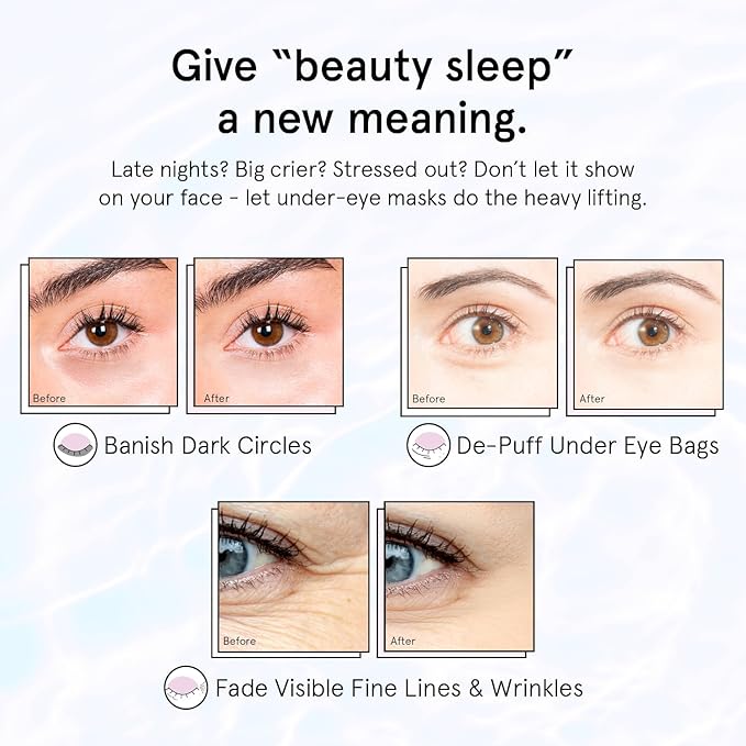 grace & stella Retinol Under Eye Patches for Puffy Eyes and Dark Circles - Restoring Gel Under Eye Masks with Hyaluronic Acid - Vegan Skincare, White Elephant Gifts for Adults (Purple, 48 Pairs)