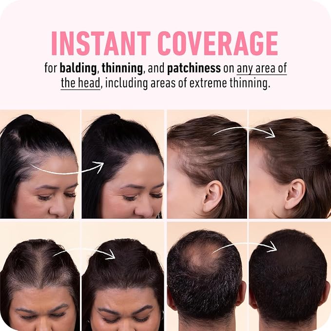 BOLDIFY Hairline Powder - Root Touch Up Hair Color for Gray Coverage - Bald Spot Concealing Hair Powder for Women & Men - 24-Hour Stain-Proof - Dark Auburn