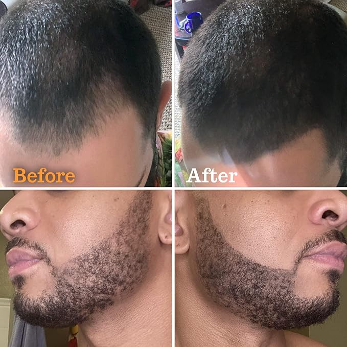 Beard Pen Filler for Men - Barber Styling Grooming Pencil - Waterproof, Sweat Proof, Long Lasting Solution with Natural Finish - Cover Beard and Scalp Patches in Seconds - Medium Black 1 Pack