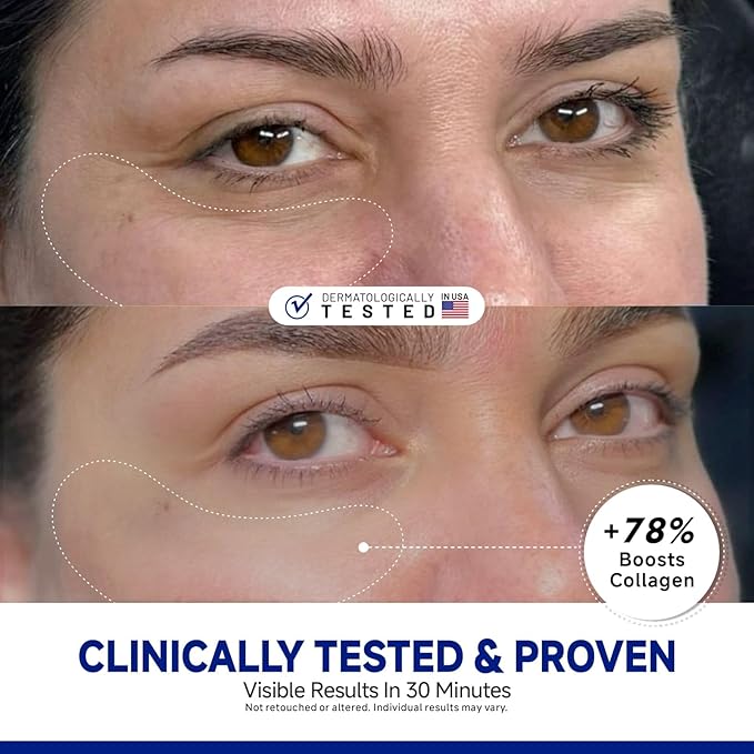 Dr Vincent Peptide Under Eye Patches, Firming Eye Patches Instant Reduces Dark Circles and Puffiness, Collagen Under Eye Mask for Bags Treatment, Wrinkles, 12 Pairs