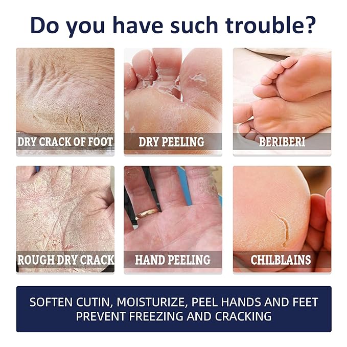 AuroraHyt Ultra-Moisturizing Cream Foot and Hand Cream, 30G, for Dry Chapped Rough Peeling Skin, Cracked Heel Treatment with Beeswax and Shea Butter