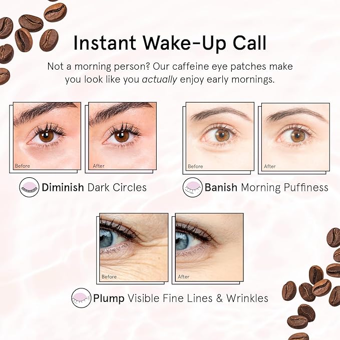 grace & stella Caffeine Under Eye Patches - Awakening Eye Patches for Puffy Eyes and Dark Circles - Under Eye Mask Patches with Niacinamide & Hyaluronic Acid - Vegan, Holiday Gift (Bronze, 6 Pairs)