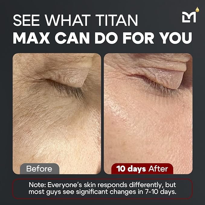 Man Labs Titan MAX Anti-Aging Face Serum for Men – Ultra Potency Mens Face Lotion – Skin Tightening Cream for Face – Mens Skin Care – Vitamin C & E, 10% Niacinamide, Hyaluronic Acid – Unscented