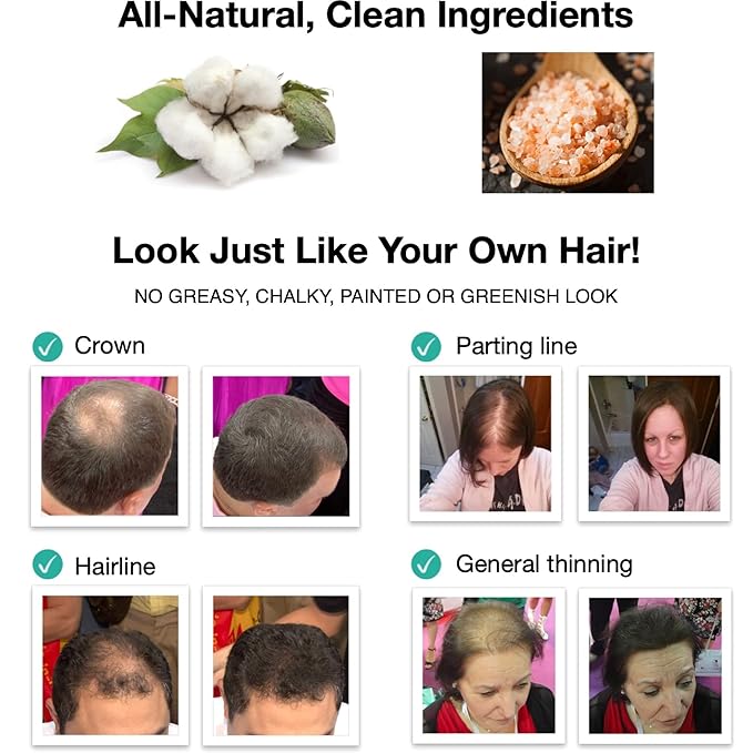 Caboki Hair Loss Concealer. All-Natural Hair Building Fiber. Make Thin Hair Look 10X Fuller Instantly. Eliminate the Appearance of Bald Spot and Thinning Hair (30G, 90-Day Supply). Gray