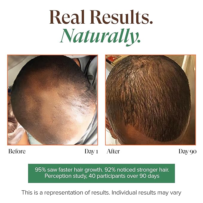 Kreyol Essence - Haitian Black Castor Oil for Skin and Hair, Glass Bottle - Fuller-Looking Hair, Hexane Free, Natural Humectant