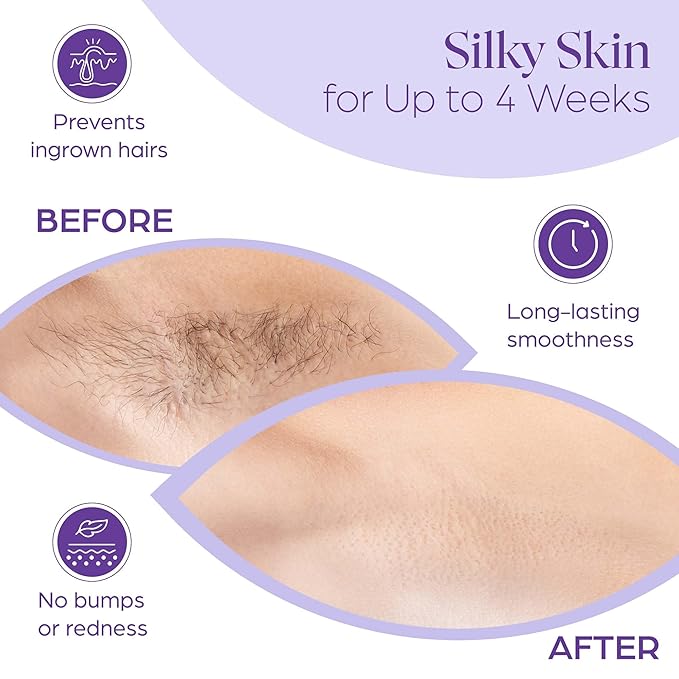 150 Wax Strips for Hair Removal – Extra-Large Non-Woven Strips for Legs, Arms, Back & Body – Works with All Soft Waxes – Salon & Home Use