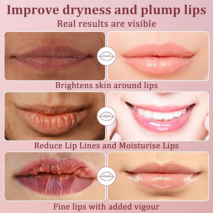 MAQIHAN 30PCS Moisturizing Lip Mask - Pink Lip Patches for Spa Daily Labial Masks Skincare Hydrating to Reduce Wrinkles Dryness Anti-wrinkle Lightens