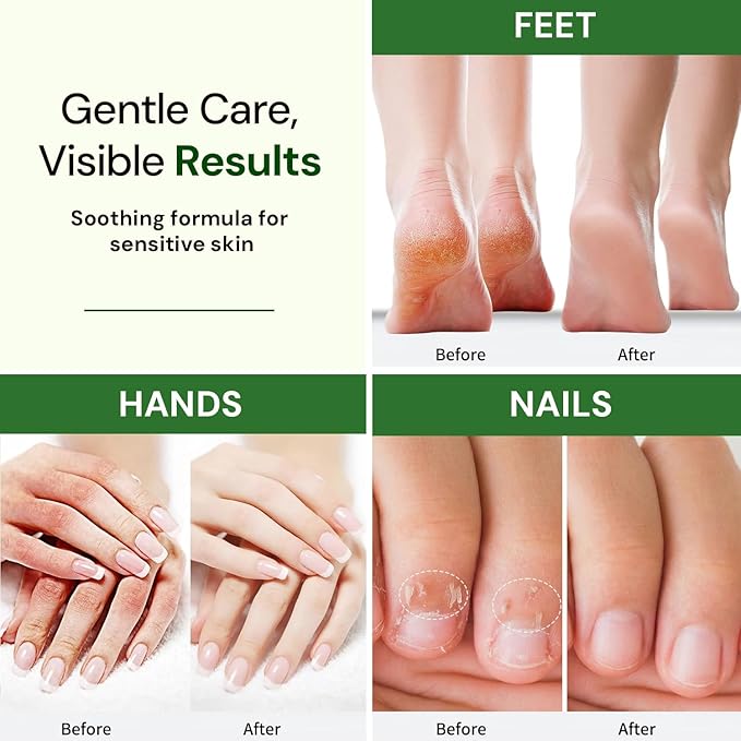 Natural Hand/Foot/Nail Cream. Organic ingredients, moisturizing, and skin nourishing. Raspberry Scent. (8oz)