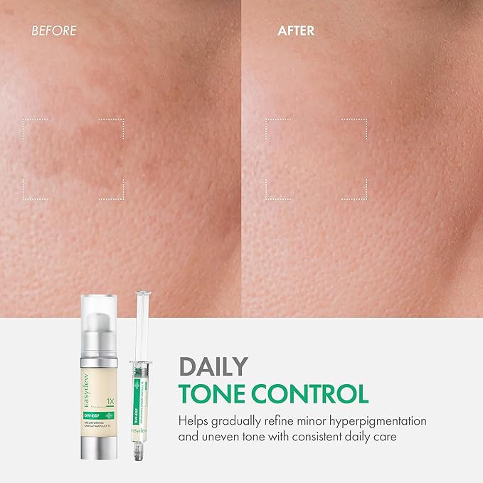 Easydew DW-EGF Melatoning Ampoule 1X - Hydrating Dark Spot Serum with Niacinamide & Glutathione for Uneven Skin - Fast Absorbing Day & Night Ampoule Korean Skin Care (Bottle 1.01 fl oz, EGF 1X)
