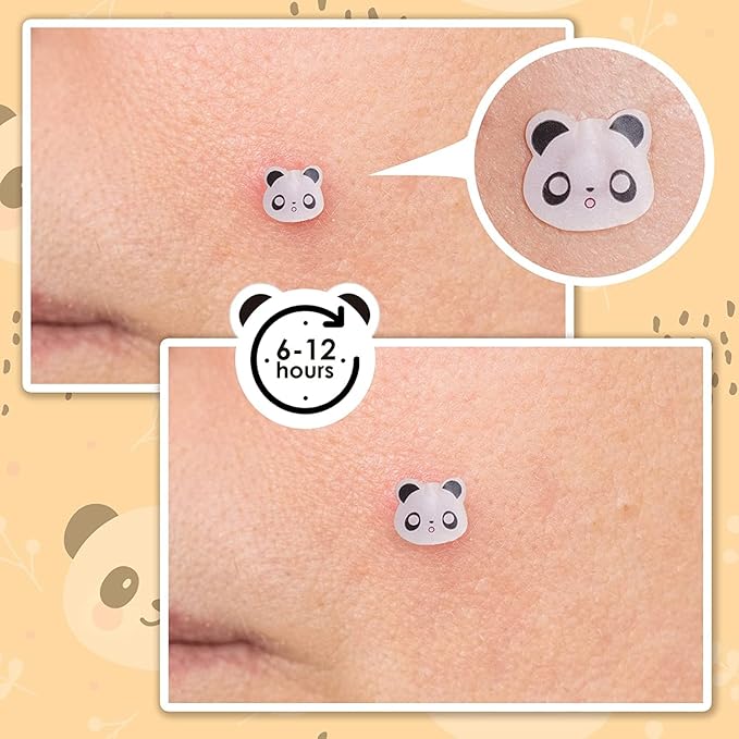 AUSLKA Panda Pimple Patches - 300 Patches, Hydrocolloid Spot Dots - Blemishes Patch - Facial Skin Care, For Zits, Blemishes, & Breakouts