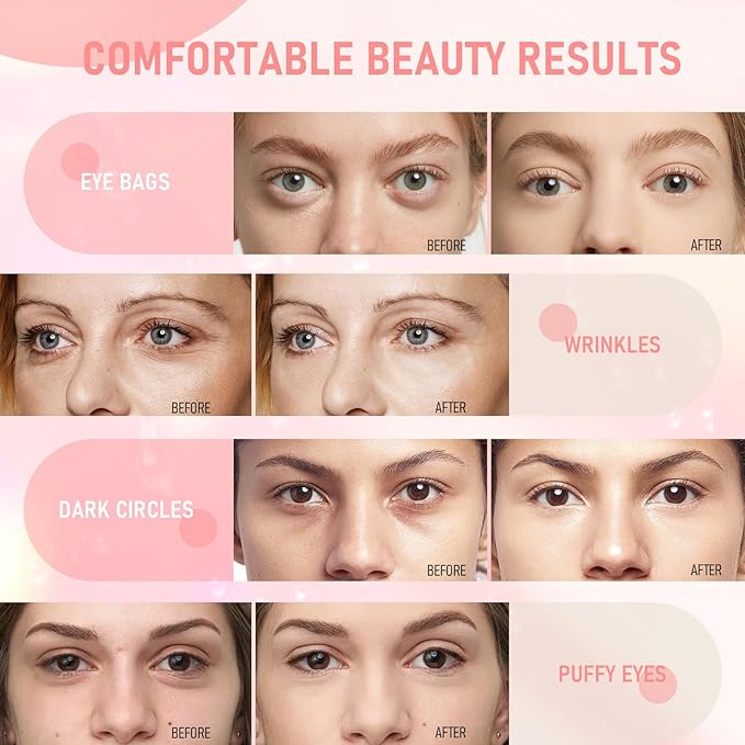 LAVONE Eye Mask - 30 Pairs Rose Under Eye Patches Skin Care Products,Eye Masks Skincare for Dark Circles and Puffiness, Reduce Wrinkles, Eye Bags and Fine Lines, for Women and Man