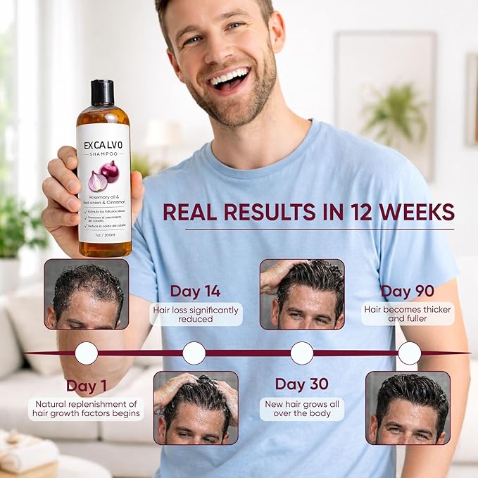 Lexenic Excalvo Shampoo - Excalvo Shampoo Para Hombre with Rosemary Oil & Red Onion & Cinnamon Extract, Menos Caída, Más Densidad, Raíces Más Fuertes, 7oz/200ml (1)