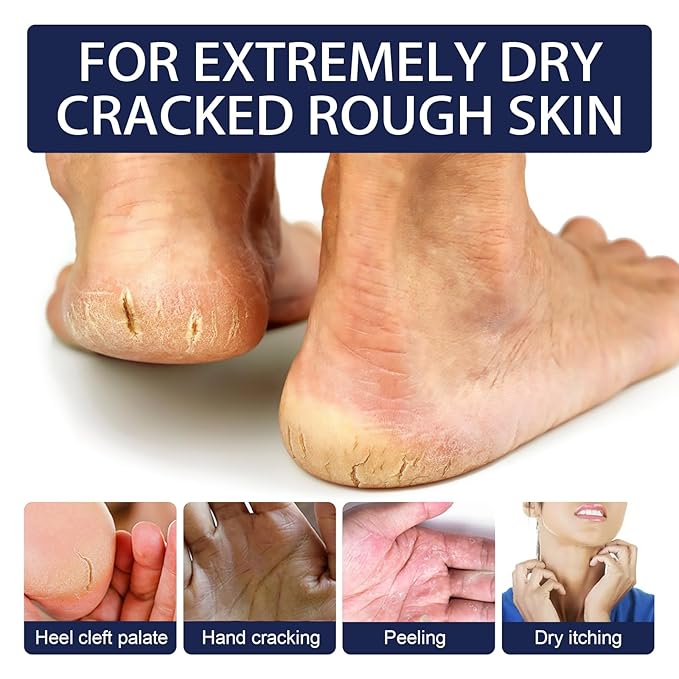 AuroraHyt Ultra-Moisturizing Cream Foot and Hand Cream, 30G, for Dry Chapped Rough Peeling Skin, Cracked Heel Treatment with Beeswax and Shea Butter