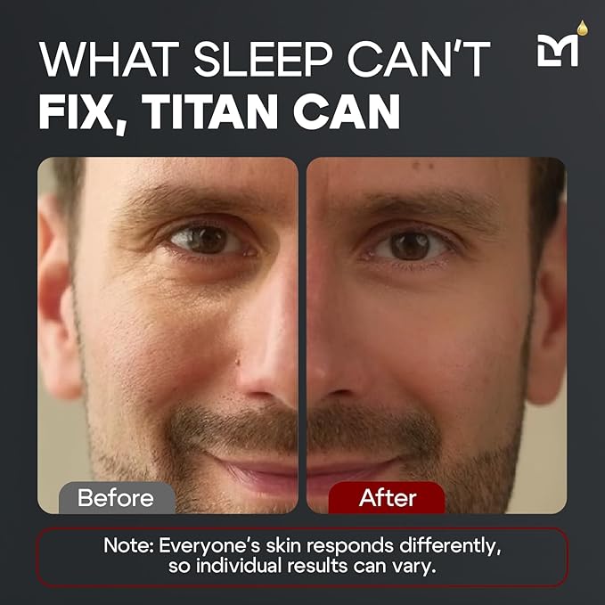 Man Labs Titan Anti-Aging Mens Eye Cream – Mens Dark Circles Under Eye Treatment – Eye Bags Treatment for Men – Crows Feet Eye Treatment Men – Peptides, HA, Herbal Extracts – All Skin Types –Unscented