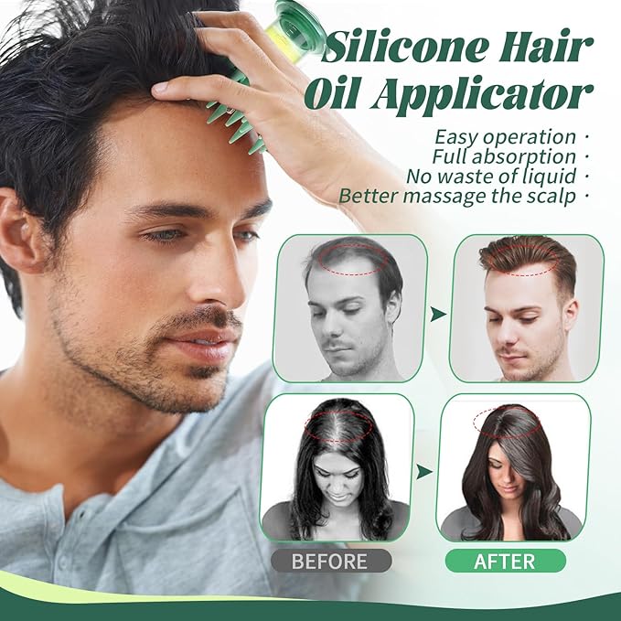 BEAUTLOHAS. Scalp Massager Applicator Comb Silicone Hair Oil & Serum Brush for Even Distribution – No Mess, Easy-to-Use Scalp Treatment Tool for All Hair Types