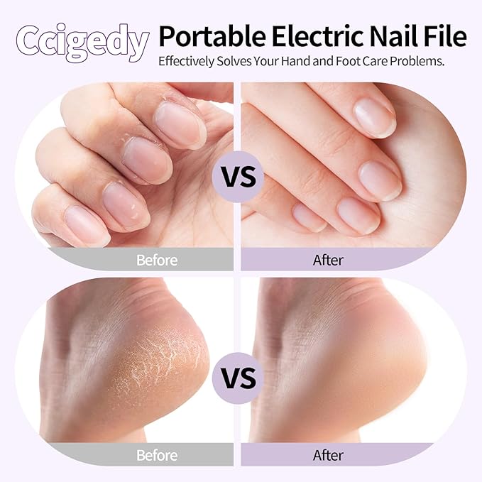 Ccigedy Professional Manicure Pedicure Electric Nail File for Thick Nails Hand Feet Care,Cordless Toenail Grinder 15 Speed,Nail Drill with LCD Screen,Ideal Valentine's Day Gift for Women/Men-Purple