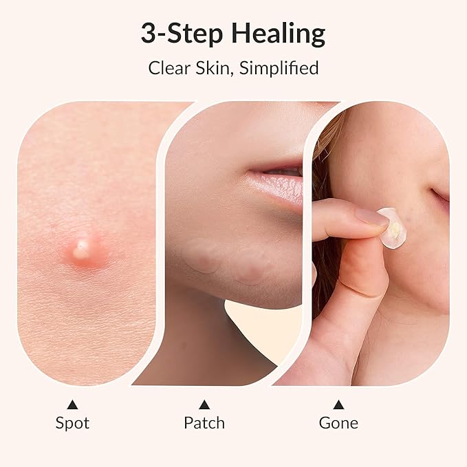 RPE Life Korean Pimple Patches – Invisible Acne Stickers with Salicylic Acid & Hydrocolloid, Miracle Patches for Pimples Zit Stickers Blemish Dots Pimple Stickers for Face Overnight Healing - 72 Count