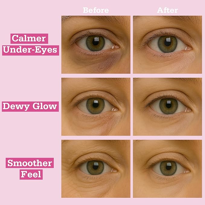 Rose Hydrogel Under Eye Patches for Dark Circles and Puffiness 28 Pairs 5 Minute Soothing Hydrating Eye Mask with Rose Extract Cooling Under Eye Pads Ophthalmologist Tested