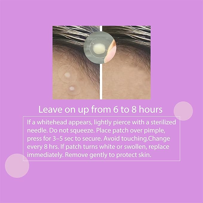 Wali Acne Patch with Tea Tree and Hydrocolloid, 72 Patches, 8mm and 12mm Sizes, Gentle for All Skin Types, Absorbs Secretions