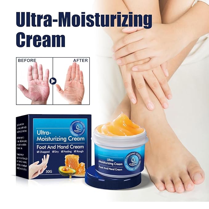 AuroraHyt Ultra-Moisturizing Cream Foot and Hand Cream, 30G, for Dry Chapped Rough Peeling Skin, Cracked Heel Treatment with Beeswax and Shea Butter