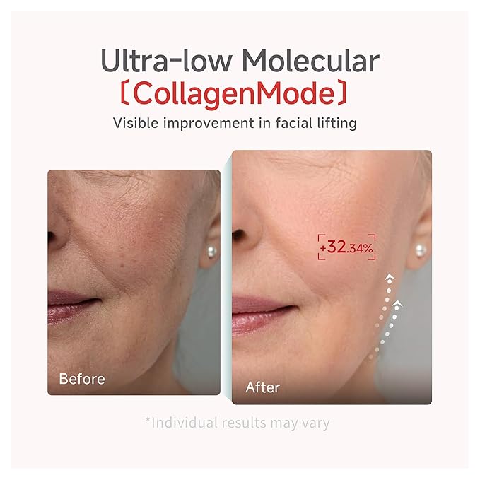 CANDORLOV Overnight Collagen Lifting Face Mask 5 Sheets, Korean Face Lifting Deep Hydrogel Mask for Glass Skin, Anti-Aging with PDRN, Hyaluronic Acid for Elasticity, Firmness