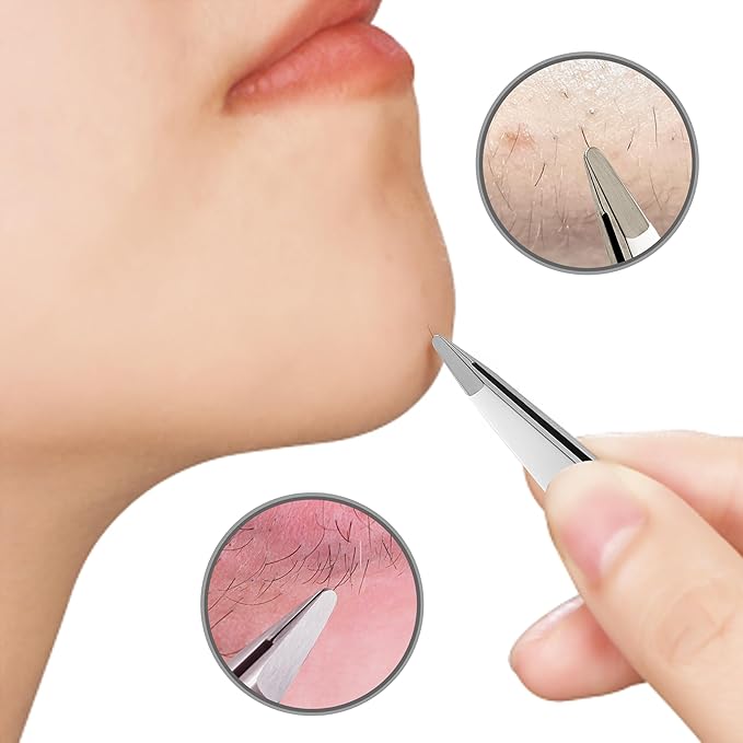 DUROX Round-Tip Tweezers — Gentle Chin & Facial Hair Removal for Women. Precision tweezers with small rounded/blunt tips for safe brow shaping and chin hair removal. Made of Stainless Steel