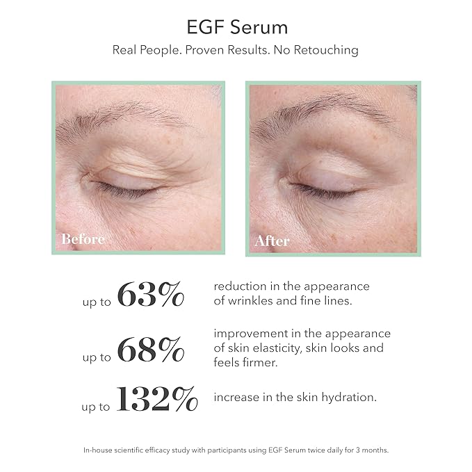 BIOEFFECT EGF Serum | Epidermal Growth Factor + Hyaluronic Acid | Age-Defying Face Treatment for Fine Lines & Wrinkles, Hydration & Firmness, 20 mL / 0.68 oz