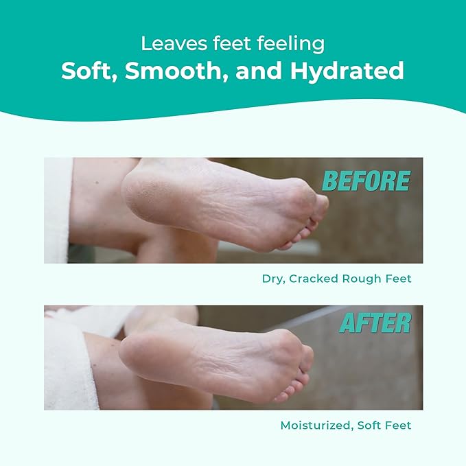 RICHENNA EZ Foot Care Cream - Advanced Exfoliating Urea Foot Cream for Dry Cracked Heels and Feet | 14 Natural Ingredients | Repairs, Hydrates and Smoothens Dry Cracked Feet - 100ml /3.38 fl. oz